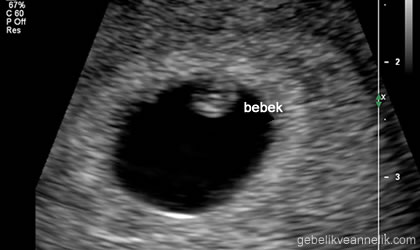 ikinci hafta bebek ultrason goruntusu