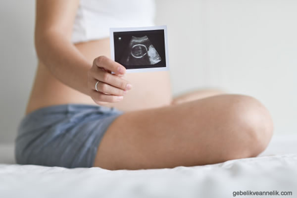 Hamilelikte Bebeğin Geriden Gelmesinin Tedavisi ve Teşhisi
