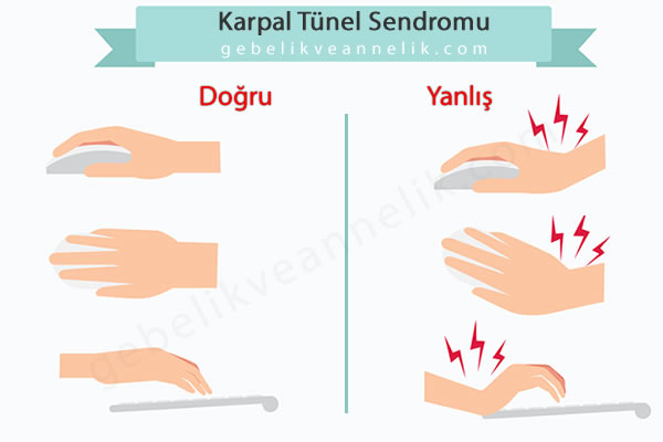 Karpal Tünel Sendromu Nasıl Önlenebilir?