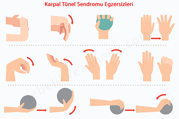 Karpal Tünel Sendromu Egzersizleri Neler?