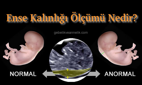 Ense Kalınlığı Ölçümü Nedir