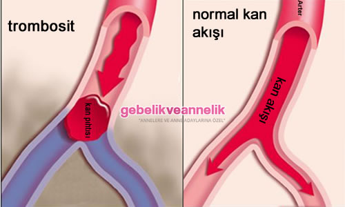 Gebelikte Kan Pıhtılaşması Belirtileri