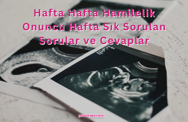 Hafta Hafta Hamilelik Onuncu Hafta Sık Sorulan Sorular ve Cevapları