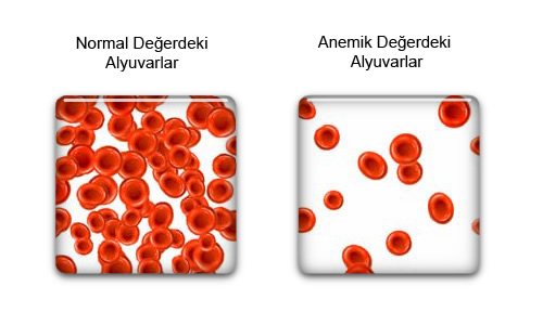 Akdeniz Anemisi Nedir?