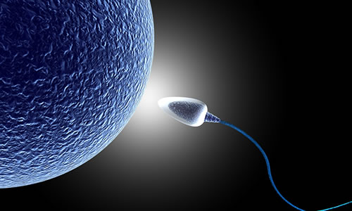 Sperm Mıknatısı Yöntemi