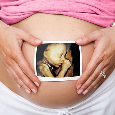 10 Haftalık Bebek Ultrason Görüntüleri