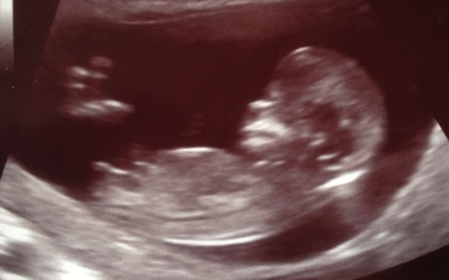 12 Haftalık Bebek Ultrason Görüntüleri