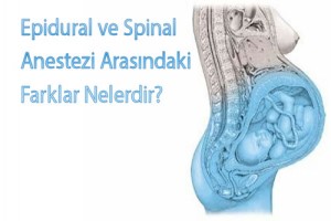 Epidural ve Spinal Anestezinin Farkı