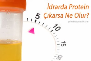 İdrarda Protein Çıkması