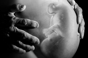 Hamilelikte Bebek Kafasının Büyük Olması